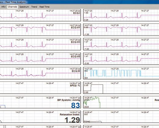 Dyna-Vision Cardio