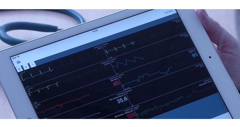 Dyna-Vision Monitoring