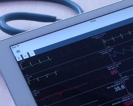 Dyna-Vision Monitoring