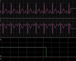 Dyna-Vision Monitoring