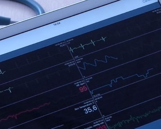 Dyna-Vision Monitoring