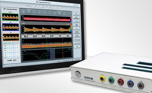 MedCat TCD Monitoring