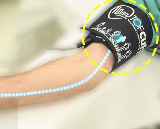 RGB Medical TOF-Cuff