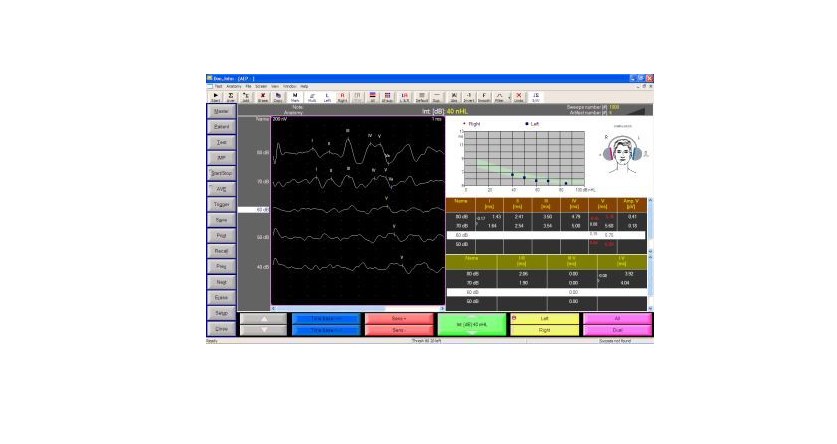 EMS Biomedical Surpass