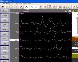 EMS Biomedical Surpass