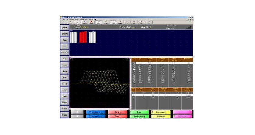 EMS Biomedical Surpass II software