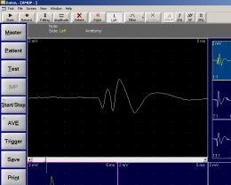 EMS Biomedical Surpass II AEP