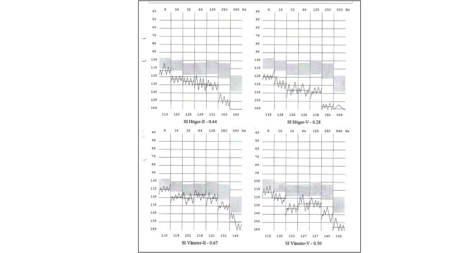 Vibrosense Meter