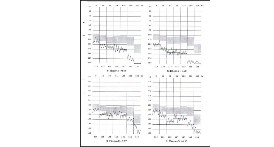 Vibrosense Meter