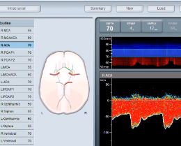 Viasonix Dolphin IQ interface
