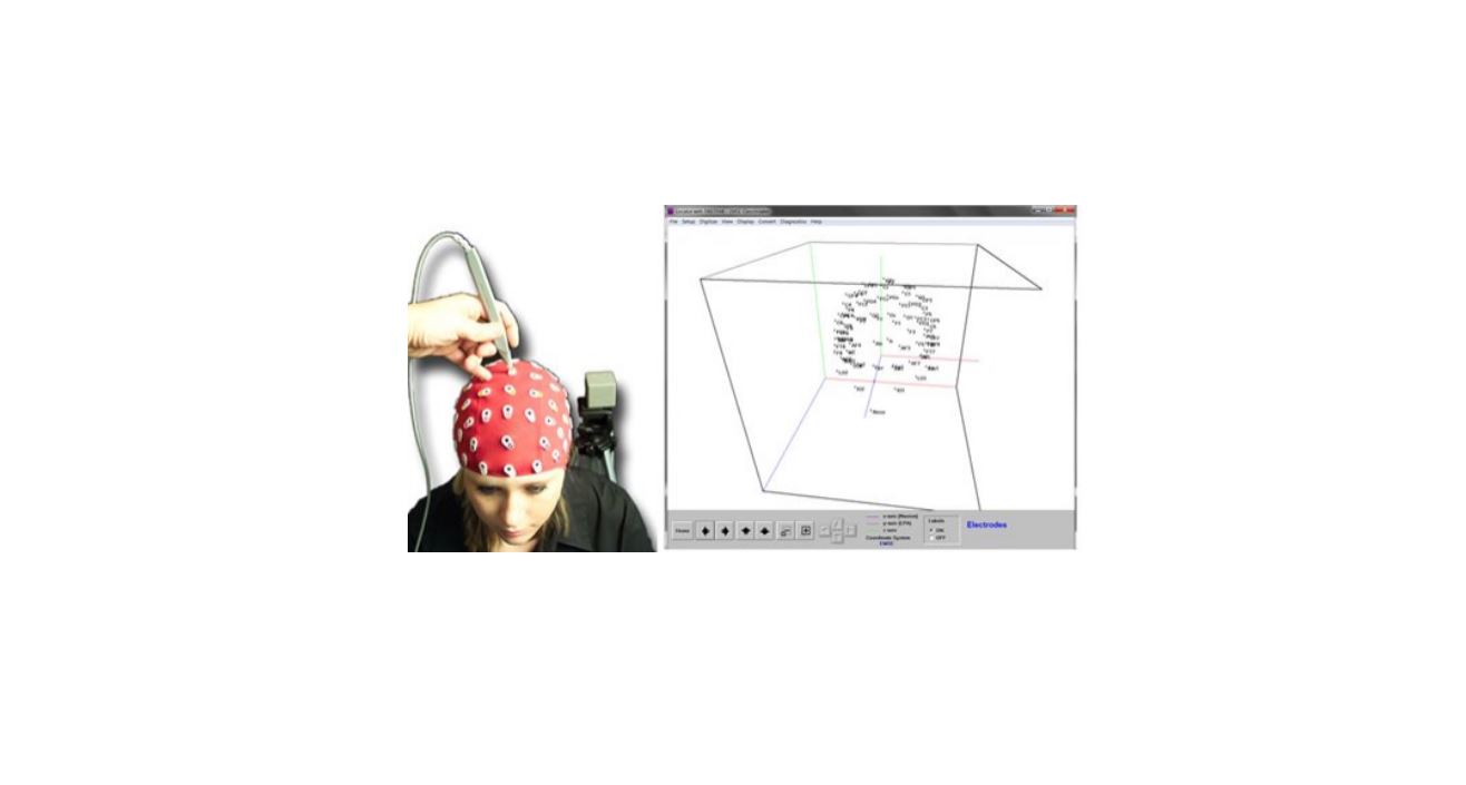 Source Signal Imaging - EMSE