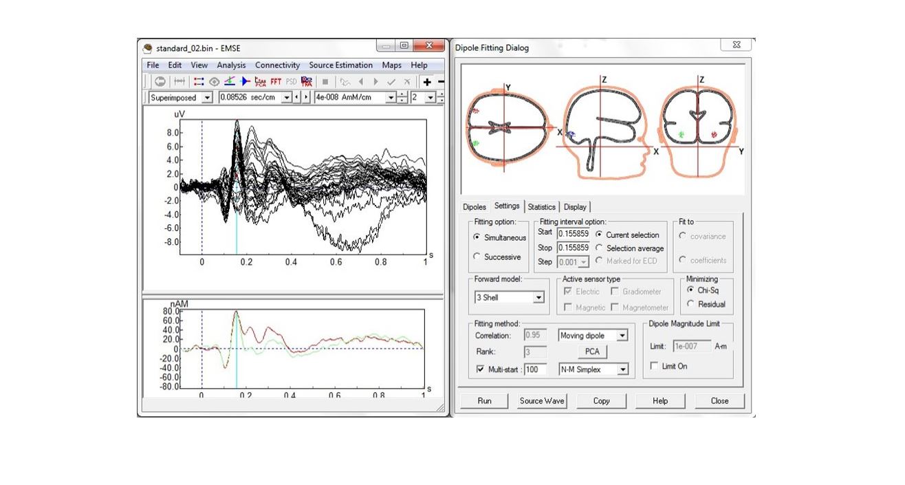 Source Signal Imaging - EMSE