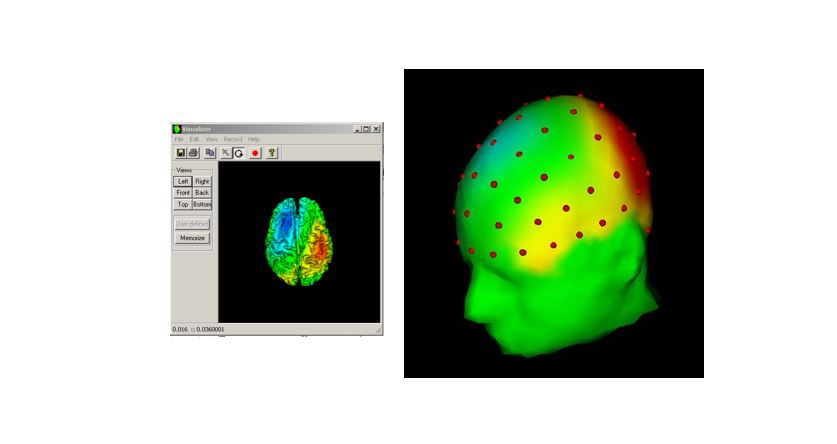 Source Signal Imaging - EMSE