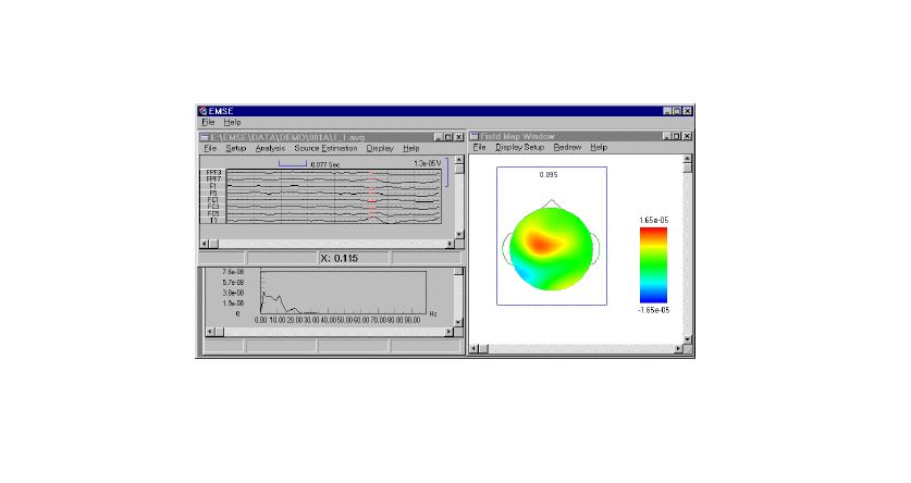 Source Signal Imaging - EMSE