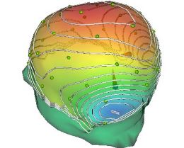 Source Signal Imaging - EMSE