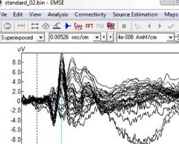 Source Signal Imaging - EMSE