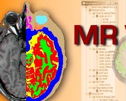 Source Signal Imaging - EMSE