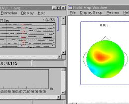 Source Signal Imaging - EMSE