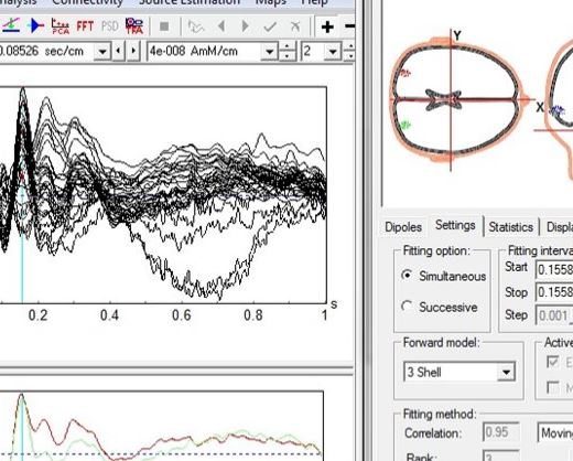 Source Signal Imaging - EMSE