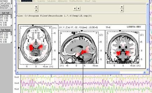 Applied Neuroscience