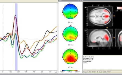 Brain Products BrainVision Analyzer Professional