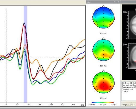 Brain Products BrainVision Analyzer Professional