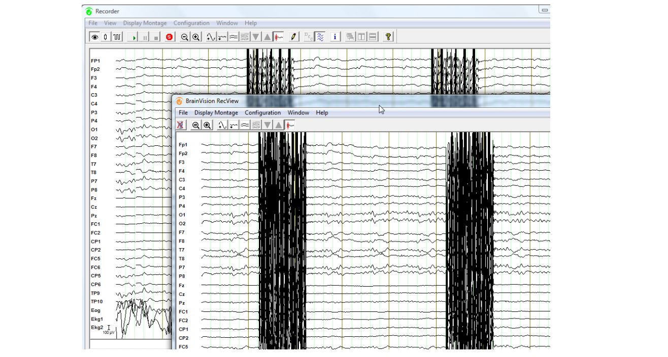 Brain Products RecView
