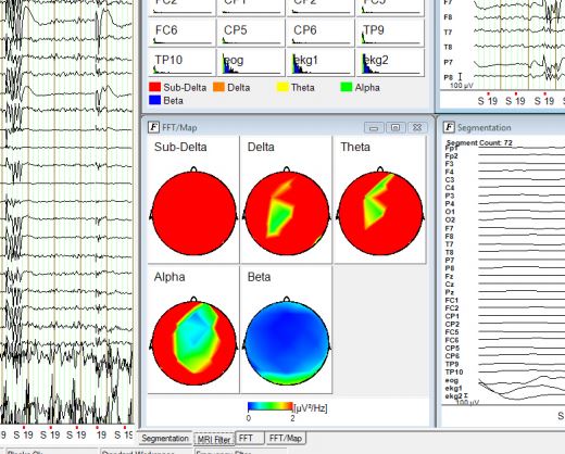 Brain Products RecView