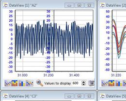 Mangold Vision Physiological Measurements