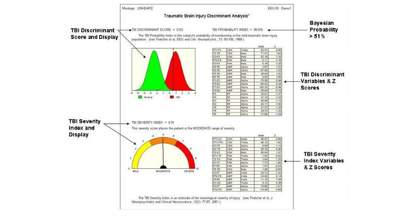 Applied Neuroscience neuroguide