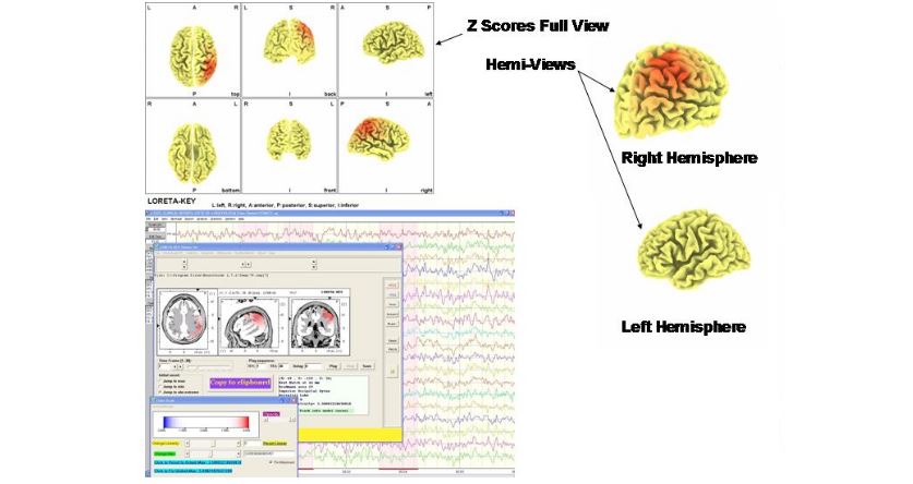 Applied Neuroscience neuroguide