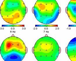 Applied Neuroscience NIRScout_extended