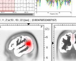 Applied Neuroscience neuroguide