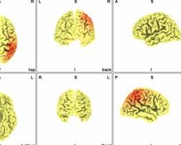 Applied Neuroscience neuroguide