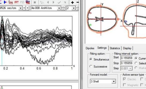 Source Signal Imaging - EMSE