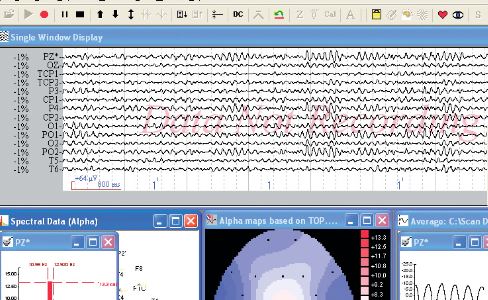 Neuroscan Scan version 4.3 software
