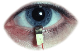 gold foil corneal electrodes